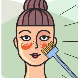 Chemical Peels