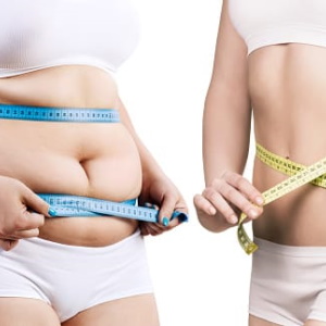 Slimming Treatment