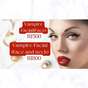 Christmas – Vampire Facial