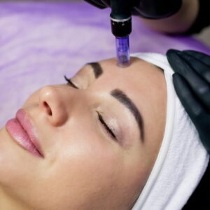Micro Needling